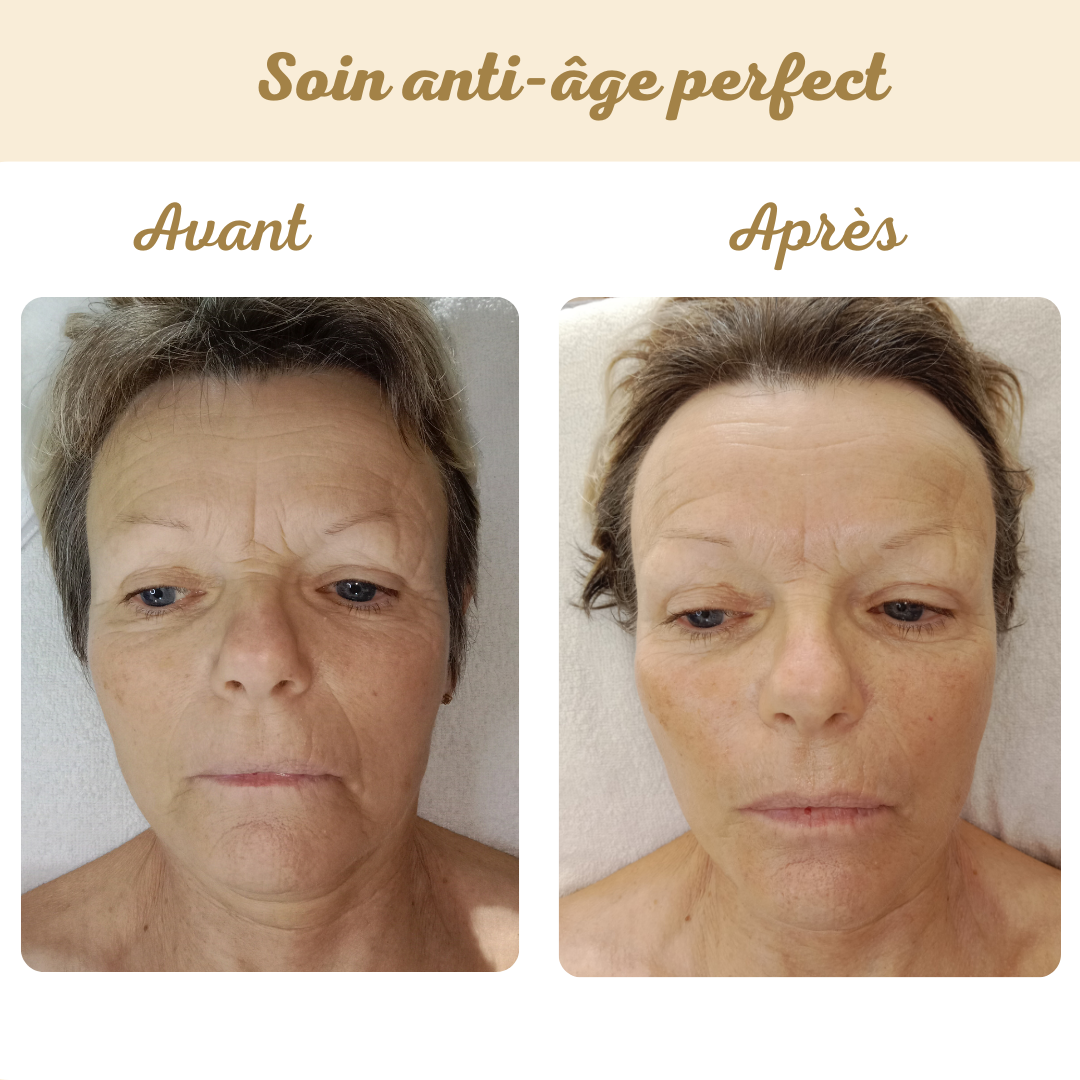 actualités soin anti age perfect